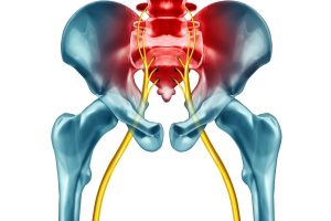 Digital picture of sciatic nerve