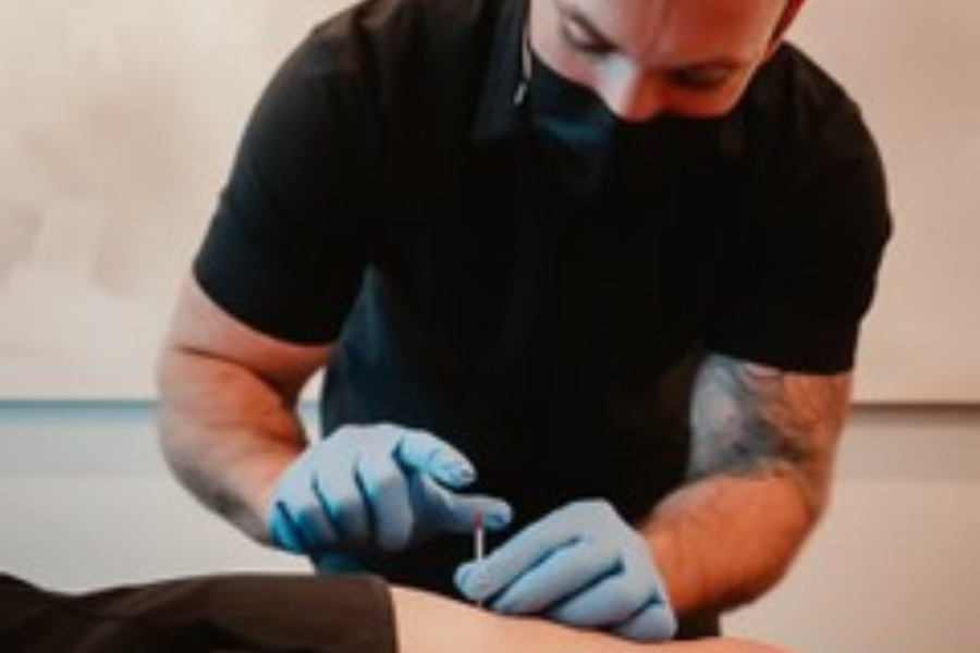 Dry Needling What It Can Do For You Affinity Wellness