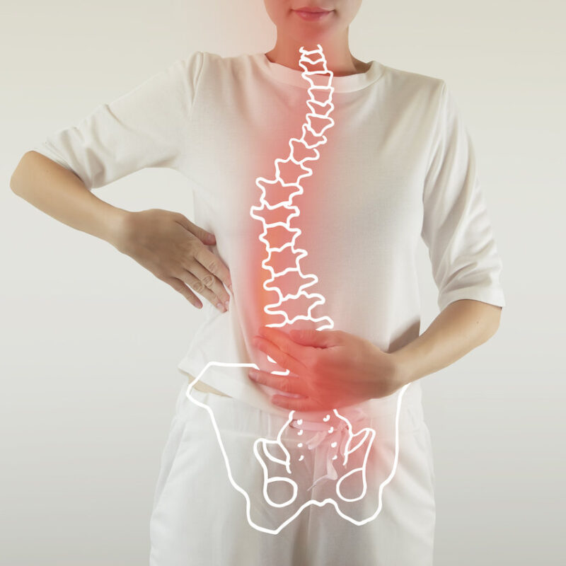 osteopathy for scoliosis